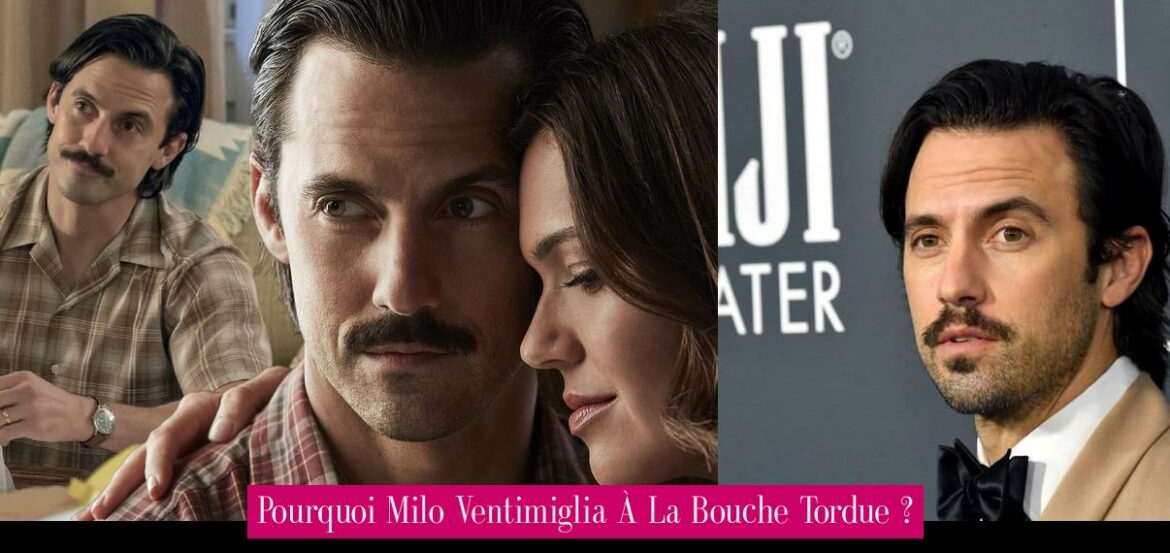 pourquoi-milo-ventimiglia-a-la-bouche-tordue