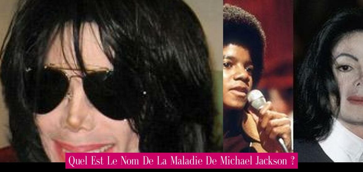 quel-est-le-nom-de-la-maladie-de-michael-jackson